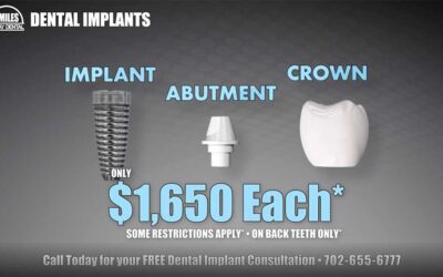 How Much Do Dental Implants Cost?
