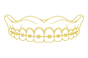 dentist in Las Vegas - Smiles Today Dental Las Vegas