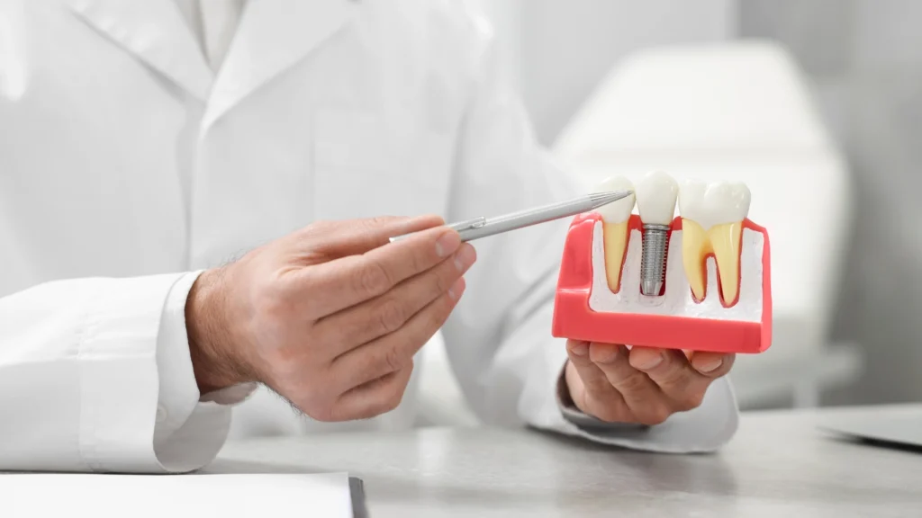 a person holding a model of dental implant