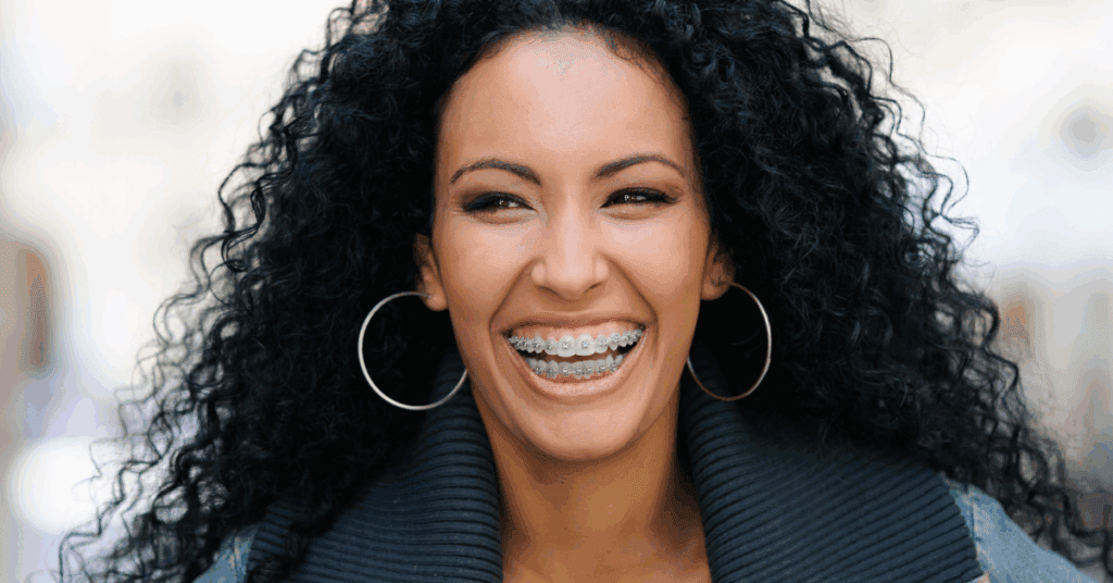 Orthodontic Treatment for Adults - Smiles Today Dental