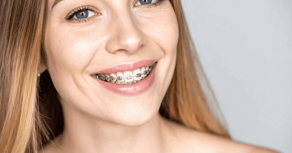 Orthodontic Treatment for Adults - Smiles Today Dental