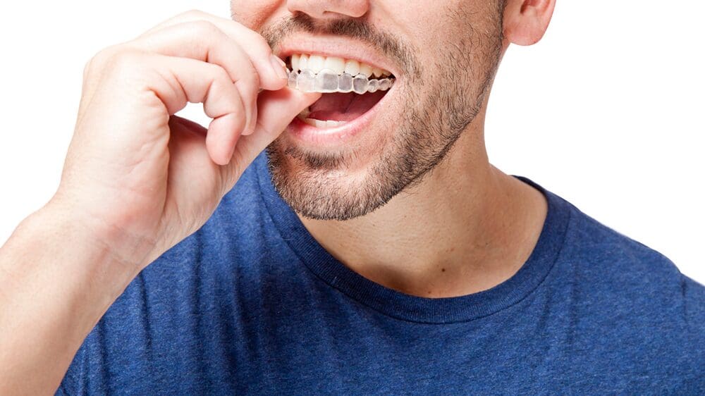 When Should You See an Orthodontist in Las Vegas - Smiles Today Dental