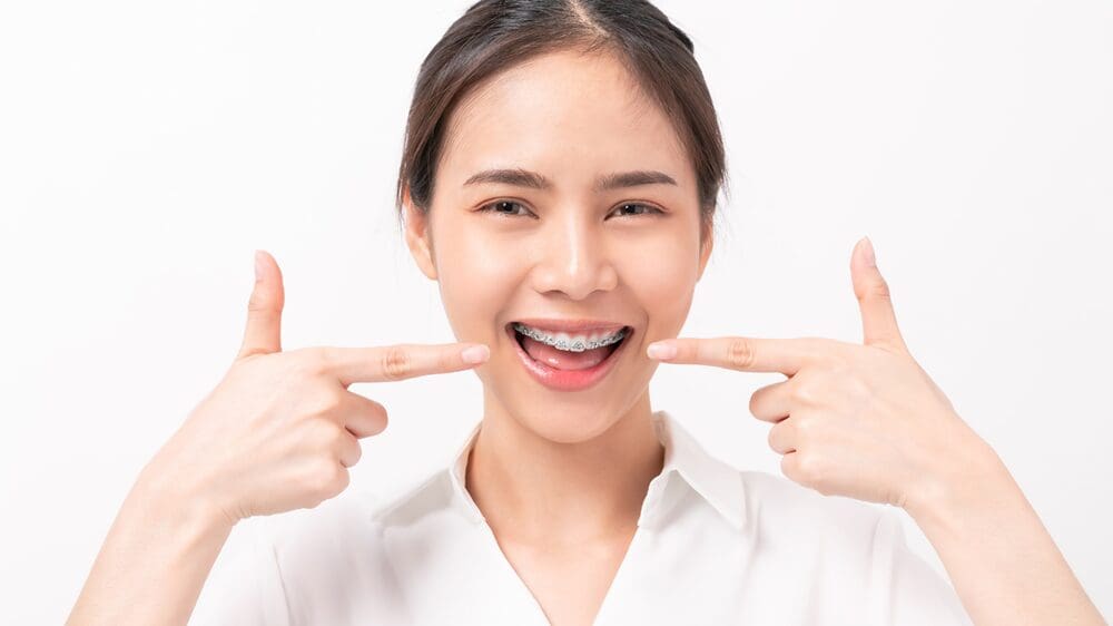 Foods to Avoid with Braces - Smiles Today Dental Las Vegas